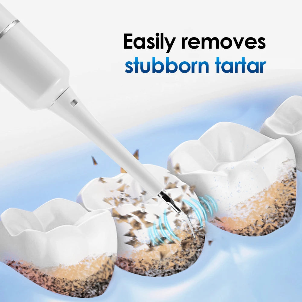 Dental Calculus Removal Electric Teeth Whitening & Cleaning Ultrasonic Tooth Cleaner Scaler Plaque Coffee Stain Tartar Oral Care