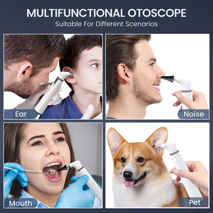 Wireless Otoscope Ear Camera with Dual View, 3.9mm 720PHD WiFi Ear Scope with 6 LED Lights for Kids and Adults, Compatible